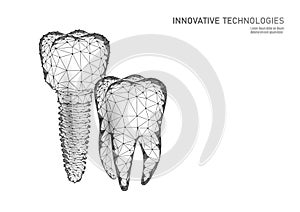 Molar tooth dental implant 3d low poly geometric model. Dentistry innovation future technology titan metal thread