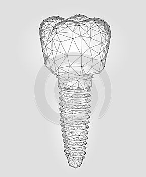 Molar tooth dental implant 3d low poly geometric model. Dentistry innovation future technology titan metal thread photo