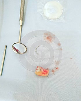 molars that have been removed from minor surgery along with surgical tools