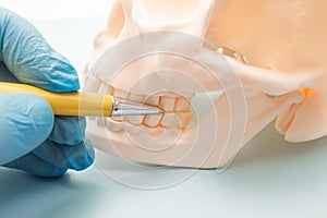 Molars on upper and lower jaw on anatomical model of the human skull. Dentist shows to patient of teeth - molars that need to be d