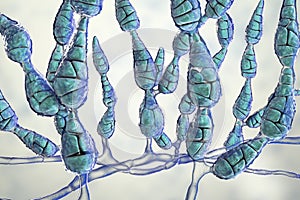 Mold Alternaria alternata, allergic fungus photo