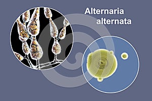 Mold Alternaria alternata, illustration and photo of colony on nutrient medium