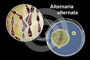 Mold Alternaria alternata, illustration and photo of colony on nutrient medium