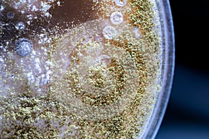 Mold Beautiful, Colony of Characteristics of Fungus Mold in culture medium plate from laboratory.