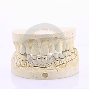 Mold of of human teeth
