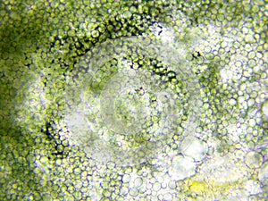 Mold microscopic view