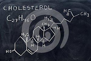 Molecular and structural formula of cholesterol photo