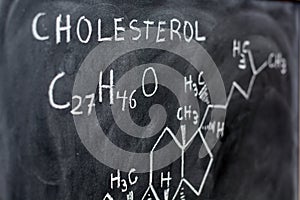 Molecular and structural formula of cholesterol photo