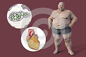 Molecule of cholesterol and obese heart in overweight man, 3D illustration. Concept of obesity and inner organs disease due to