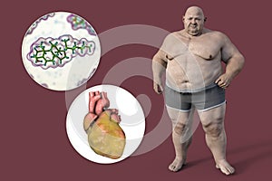 Molecule of cholesterol and obese heart in overweight man, 3D illustration. Concept of obesity and inner organs disease photo