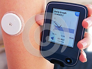 Moment of  reading a glucose levels using device for continuous glucose monitoring in blood Ã¢â¬â CGM. photo