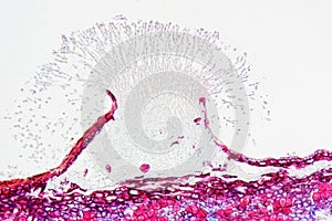 Monilinia fructigena under the microscope