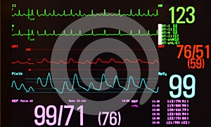 Monitor with Atrial Flutter photo