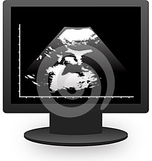 Monitor echography