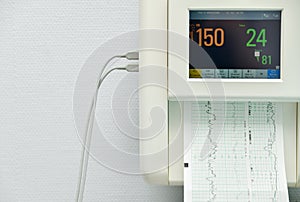 Monitor for measuring contractions, heartbeat of a pregnant woman in a hospital