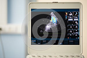 Monitor of modern ultrasound scanner with heart scan.