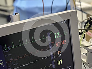 Monitor in operating theatre to measure vital signs of a patient undergoing surgery.