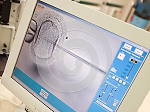 Monitor showing intra cytoplasmic sperm injection