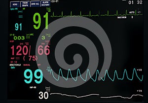 Monitor vital sign and EKG monitor in ICU unit ,it show The waves of blood pressure, blood oxygen saturation, ECG,heart rate,res