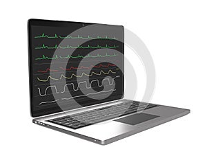 Monitoring display of patient vital signs on laptop computer