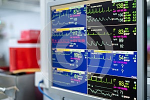 Monitoring of ECG, blood pressure, saturation of the patient in ICU.