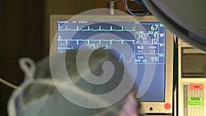 Monitoring patient vitals during surgery (2 of 5)