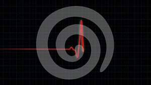 Monitoring vital signs of the patient on medical monitor