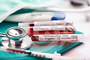Monkey pox test tube on medical desk