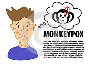 Monkeypox inphographic banner design. Male suffering from new virus Monkeypox. Monkeypox virus alert danger icon sign photo