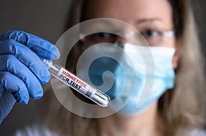 Monkeypox PCR test tube in doctors hand