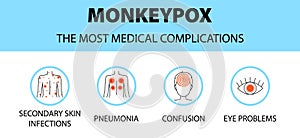 Monkeypox virus icons infographic. The most medical complications. New outbreak cases in Europe and USA