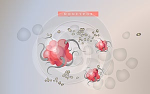 Monkeypox Virus - Stock Illustration