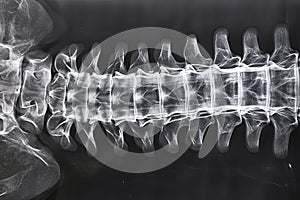 A monochrome photograph capturing the detailed structure of a tooth, X-ray film of the entire spinal column, AI Generated
