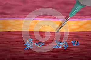 Monoclonal antibody treatment (Adalimumab) - top view 3d illustration