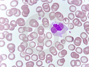 Monocyte cell in blood smear
