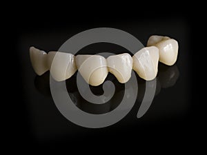 Monolithic zirconia restorations full arch implant supported wit