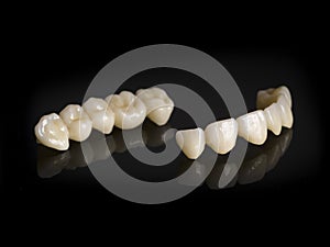 Monolithic zirconia restorations full arch implant supported wit