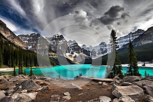 Moraine lake in Banff National Park, Canadian Rockies, Canada.