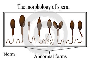 The morphology of the sperm. Normal and abnormal