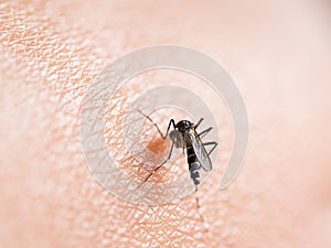 Mosquito bite on human skin