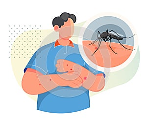 Mosquito biting on Human Skin - Stock Illustration