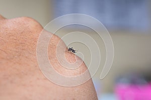 Mosquito sucking human blood