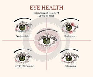 Most common eye problems.