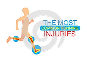 The most common running injuries photo