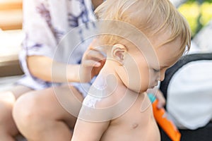 Mother applying sunscreen protection creme on cute little toddler boy shoulder. Mom using sunblocking lotion to protect