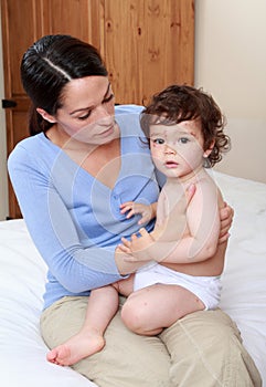 Mother and baby with chickenpox