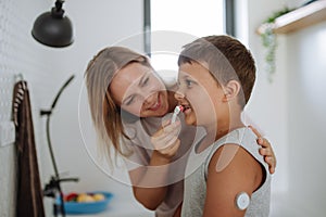 Mother helping diabetic boy to brush his teeth in the morning, while wearing a continuous glucose monitoring sensor on