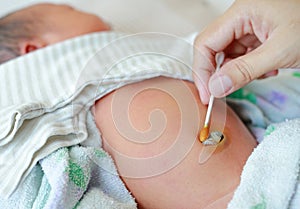 Mother use cotton swab moistened with alcohol to wipe clean the navel umbilical cord baby newborn
