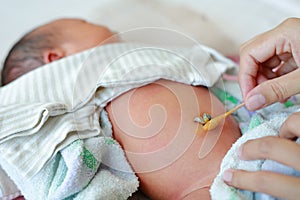 Mother use cotton swab moistened with alcohol to wipe clean the navel umbilical cord baby newborn
