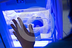 Mother watching at the Newborn baby with hyperbilirubinemia / Neonatal jaundice under blue UV light for phototheraphy on infant